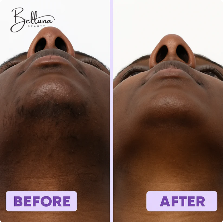 Belluna Lumière Serum